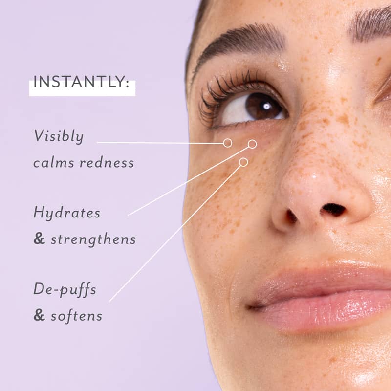 Skin Remedy Soothing Eye Gels (5 Pack)